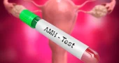 AMH-Test