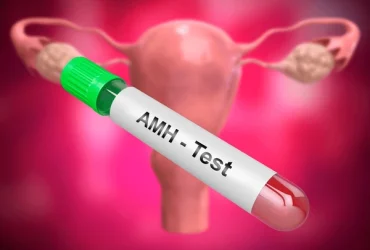AMH-Test