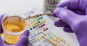 Urine-Drug-Test
