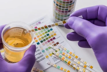 Urine-Drug-Test