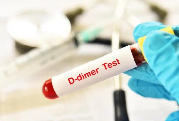 d-dimer-test-price