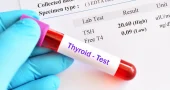 hypothyroidism-result-with-blood-sample-tube