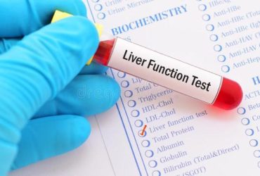 liver-function-test-blood-sample-102023306