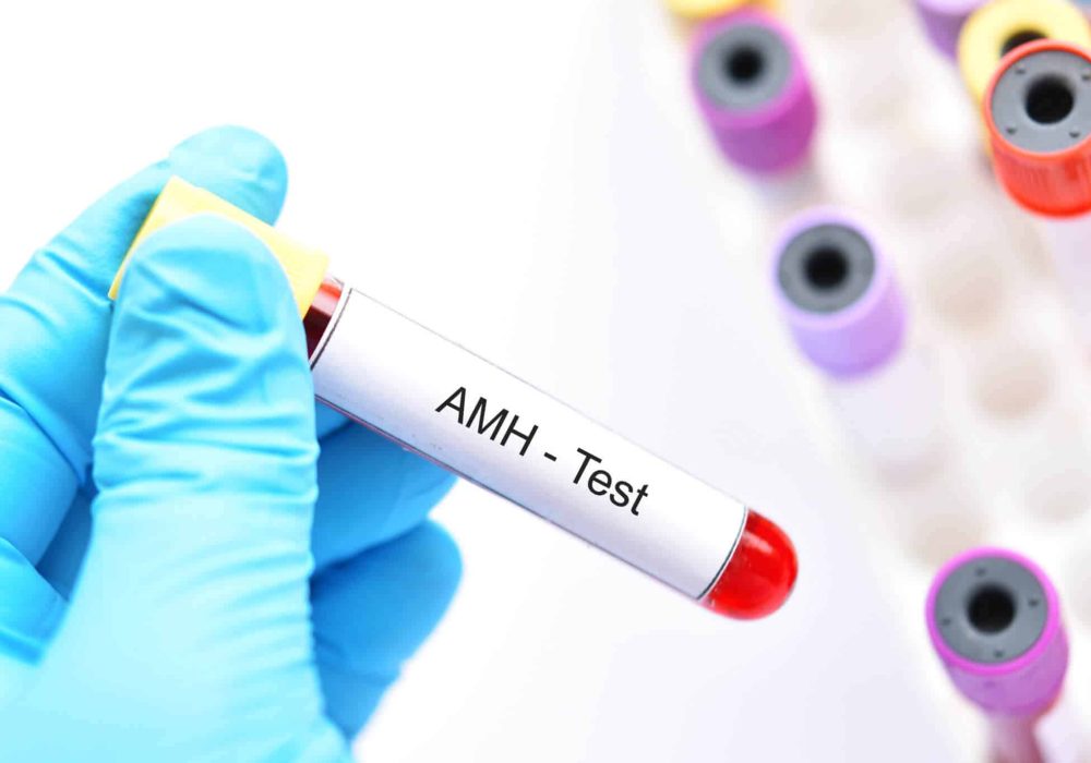 How-to-increase-AMH-levels-naturally-1