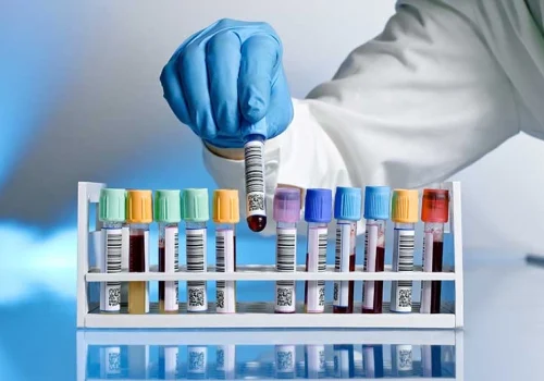 Laboratory Tests